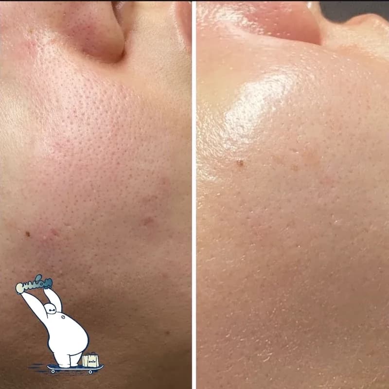 ژل شستشوی صورت ایتالیایی اورجینال | رژینا ژل شستشوی صورت ایتالیایی اورجینال