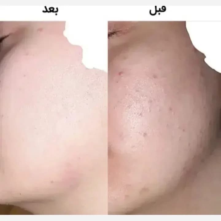 کرم ضد لک لاکچری کوین | رژینا کرم ضد لک لاکچری کوین